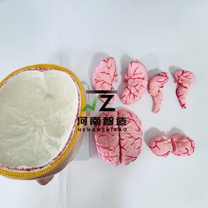 Modelo Anatómico de las Arterias Cerebrales en Relación con la Cabeza Humana - Modelo de Enseñanza y Entrenamiento Médico - Product Image 3