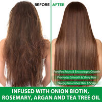 Label pribadi sampo rambut Biotin Gel, bentuk mencegah ketombe mengurangi kekeringan dengan minyak biji labu Rosemary