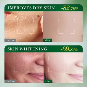 Mascarilla Facial de la <span class=keywords><strong>Serie</strong></span> de Plantas Frutales de Marca Privada FAYANKOU, Mascarilla Facial <span class=keywords><strong>Coreana</strong></span> para el Cuidado de la Piel, Vitamina C, Iluminadora e Hidratante - Product Image 5