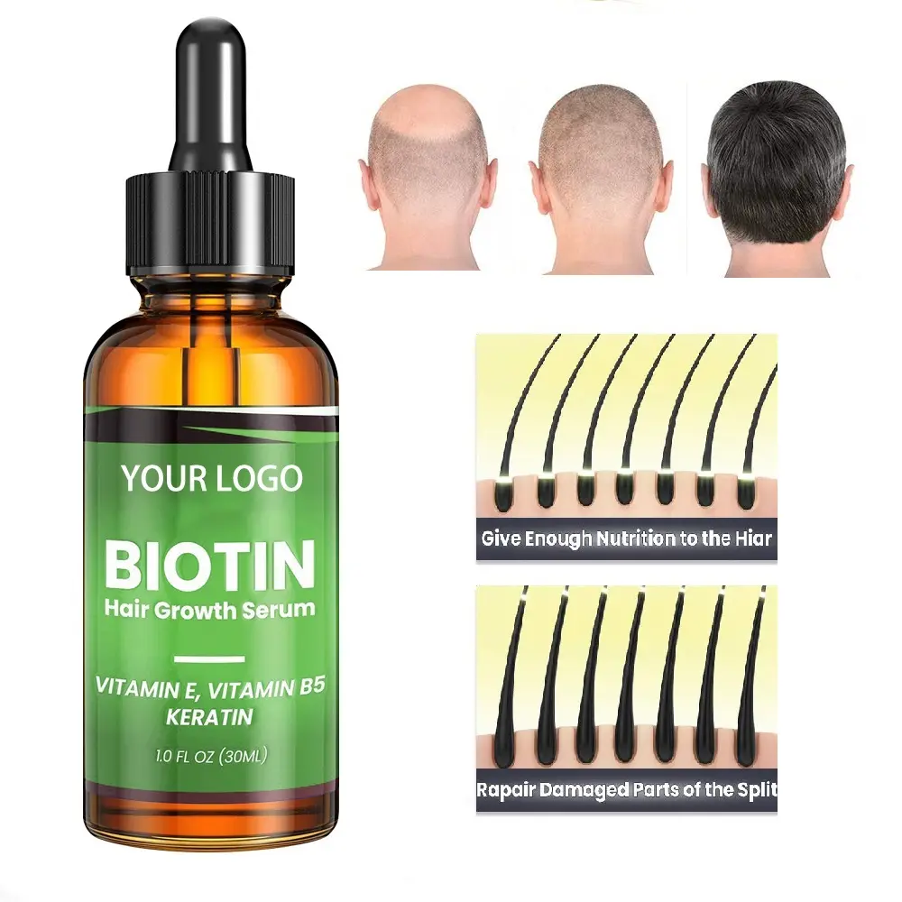 Private Label Dandruff Moisturizing Hair Growth Oil for Bald Hair Serum Wholesale Anti Hair Loss Oil