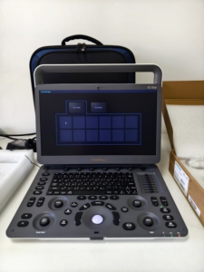 Échographe portable SonoScape E1 Exp avec Doppler couleur pour l'examen de l'abdomen, obstétrique/gynécologie, petites parties et vasculaire - Product Image 6