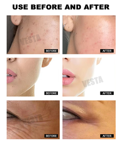 फेस ब्राइटनिंग किट स्पा सीरम पेप्टाइड सोने के लिए अनुकूलित सीरम पेप्टाइड गोल्ड एम्फोल्स स्किन बूस्टर किट - Product Image 6