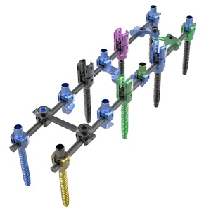 Canwell polyaxial pedicle vít và que thoracolumbar phẫu thuật CE chứng nhận Titan mis cột sống cố định hệ thống - Product Image 1