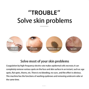 Dispositivo de Belleza para Eliminar Manchas Faciales y de Manos, para Uso Doméstico, Eliminador de Verrugas, Lunares y Acrocordones, Material ABS - Product Image 3