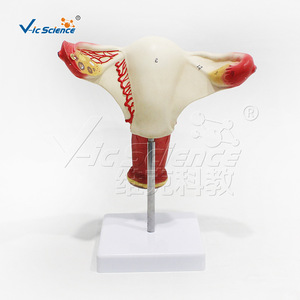 Modèle de l'utérus du système reproducteur féminin, en PVC haute précision, avec des étiquettes numériques correspondant aux noms des organes. - Product Image 3