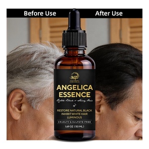 Tratamiento OEM ODM para el Cabello Gris para Hombres y Mujeres, Tratamiento para Cabello Canoso, Tratamiento para Convertir el Cabello Gris en Negro, Suero <span class=keywords><strong>Angelica</strong></span> Anti-Canas - Product Image 4