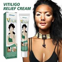 OEM Personnalisé South Moon 20g Traitement du Vitiligo Psoriasis Anti Bactérien Pommade Localisée Plâtre pour Taches Blanches Mycose Leucoplasie