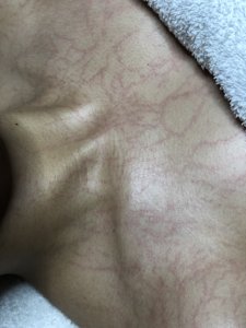 Maschera Enzimatica Esfoliante per Ossigenoterapia a Marchio Privato, Trattamento Cosmetico Anti-Età in Polvere - Product Image 6