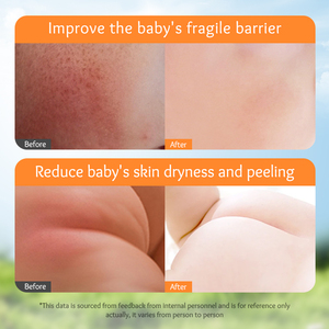 SADOE Shampooing et Gel Douche Naturel à la Calendula et aux Acides Aminés, Volumisant et Doux - Product Image 5