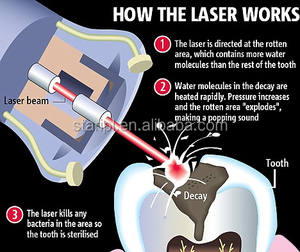 NSK strumenti dentali 1470nm 980nm Laser a diodi per lo sbiancamento dei denti impianto dentale Turbina di bellezza e di cura personale - Product Image 2