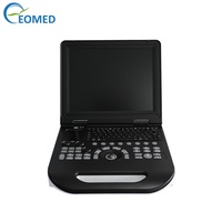 Système d'échographie Doppler couleur portable EO-Med CU30 avec écran LCD de 15 pouces, 2 connecteurs de sondes, batterie de 4,5 heures