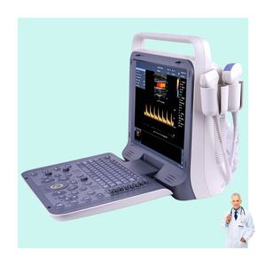 Draagbare P60 Human Color Doppler Echografie - 15-inch 3D/4D HD-beeldvorming voor detectie van buik- en zwangerschapsziekten in de baarmoeder - Product Image 1