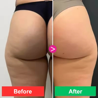 Crème Rosa Adeus 300g, crème corporelle multifonctionnelle intensive, anti-cellulite, élimination des vergetures, raffermissant et hydratant pour la peau