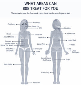 เครื่องกำจัดขนด้วยไดโอด 810 นาโนเมตร ระดับมืออาชีพ พร้อมอะแดปเตอร์แม่เหล็กสำหรับริมฝีปากบน รักแร้ ขา และบริเวณร่างกายอื่นๆ ในร้านเสริมสวย - Product Image 2