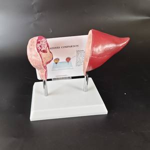 Comparación de Órganos Viscerales Normales con Corazón, Pulmón, Vejiga, Vasos, Tráquea Oral, Modelo Médico Fetal - Product Image 3