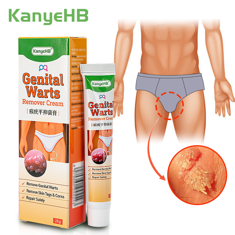 KanyeHB Genital Wart Treatment Papillomas Removal of Warts Ointment From Skin Tags Removing Against Moles Remover