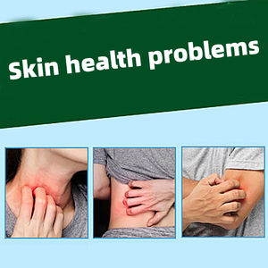 Envío Gratuito, Precio al por Mayor, Esencia Herbal para el Cuidado de la <span class=keywords><strong>Piel</strong></span>, Limpieza, Bacteriostasis y <span class=keywords><strong>Tratamiento</strong></span> para Mantener la Salud del Pie - Product Image 6