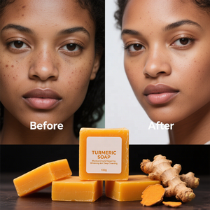 Jabón de limón de cúrcuma hecho a mano de etiqueta privada con jabón corporal hidratante blanqueador de Ácido Kójico - Product Image 1