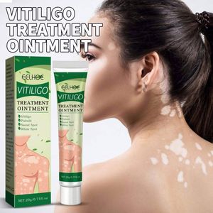 EELHOE Vitiligo Traitement Crème Ointment pour l'élimination des <span class=keywords><strong>taches</strong></span> <span class=keywords><strong>blanches</strong></span>, de la teigne, de la leucoplasie cutanée et de la dermatite 20ml EELHOE Vitiligo - Product Image 2
