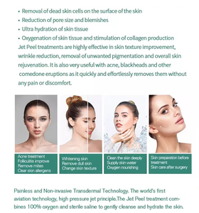 Máquina Hidra Multifunción con Tecnología Transdérmica sin Agujas para la Eliminación de Piel Muerta, Mejora de la Foliculitis y Nutrición con Oxígeno - Product Image 4