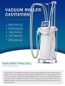 2025 Rouleau Massant Endermologie Verticale Vela Roller Liposuccion Aspiration Cellulite Machine Amincissement Sculptage Corpore - Product Image 2