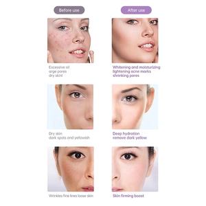 Mesin Terapi Meso Profesional NewFace untuk Perawatan Kulit Wajah, Panjang Gelombang dan Intensitas Dapat Disesuaikan, Warna Merah Hijau Biru, untuk Penggunaan di Rumah - Product Image 6