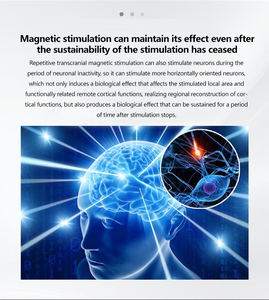 Suministros Médicos, Equipo de Atención Médica, Instrumento de Rehabilitación Cerebral, Masajeador de Cabeza, Estimulación Magnética Transcraneal - Product Image 5