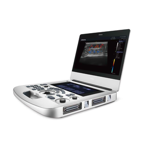 <span class=keywords><strong>Edan</strong></span> acclarix Ax3 Vet siêu âm DOPPLER màu máy siêu âm cao cấp thú y Hệ thống hình ảnh cho động vật phòng khám giá tốt - Product Image 2