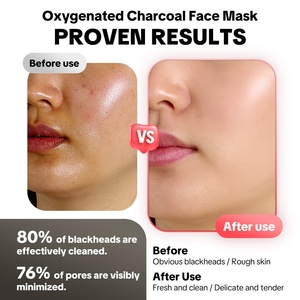 Làm sạch sâu có ga Mặt nạ bong bóng mặt chống mụn trứng cá kiểm soát dầu Mặt nạ bong bóng mặt nạ đất sét bùn vẻ đẹp chăm sóc khuôn mặt - Product Image 4