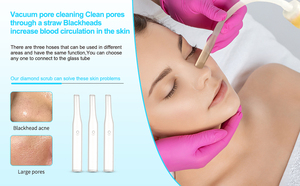 Mini máquina de belleza para el cuidado de la piel con microdermoabrasión para la reducción de puntos negros y limpieza de poros para uso doméstico. - Product Image 5