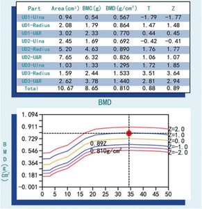 DXA-500B 5 Seconds High Speed Dual-energy X-ray Absorptiometry Bone Densitometer - Product Image 3
