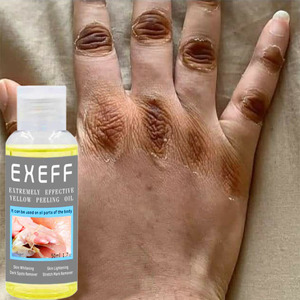 Vàng lột dầu đốt ngón tay làm trắng da loại bỏ da chết tẩy tế bào chết thêm mạnh mẽ lột dầu cho cơ thể - Product Image 1