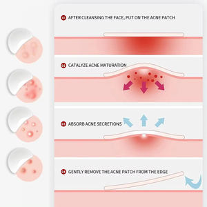 Parche Curativo para el Acné de Marca Privada, Cuidado de la Piel Invisible, Parche para el Acné con Ácido Hialurónico - Product Image 3