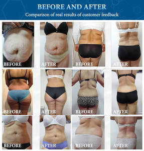 Lymph drainage walzen maschine Ganzkörper-Schlankheit massage anzug mit Luft kompression stech no logie - Product Image 5