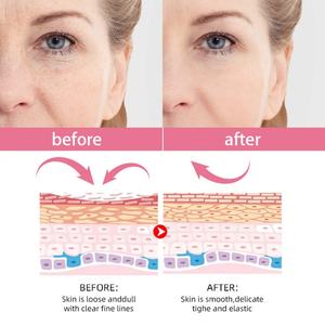 5 in 1 Anti Aging Wrinkle Moisturizer Dark Spot Vitamin E Collagen Hyaluronic Acid Vitamin C Face <b>Serum</b> for Women - Product Image 3