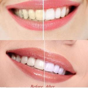 ผงถ่านไม้ไผ่เพื่อสุขภาพฟันฟันฟันขาวปลอดภัยต่อสุขภาพ - Product Image 2