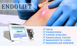 Dispositivo de Tratamiento de Celulitis con Láser Endolipolítico, Cánula de Liposucción para Disolver Grasa, Lipo Diodo 980nm 1470nm, Láser de Diodo para Papada, Tratamiento Mini Invasivo - Product Image 2