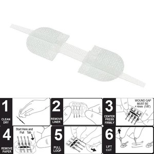 แผ่นปิดแผลแบบซิป <span class=keywords><strong>3</strong></span> ชิ้น/ชุด แผ่นปิดแผลห้ามเลือด ปิดแผลเร็ว แผ่นปิดแผลแบบซิป แผ่นปิดแผลแบบกำหนดเอง - Product Image 5