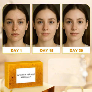 Savon de Bain Artisanal Hydratant Éclaircissant à l'Extrait de Curcuma de Qualité <span class=keywords><strong>Clinique</strong></span> et à l'Acide Kojique pour l'Hyperpigmentation, Lissant et Illuminateur - Product Image 3