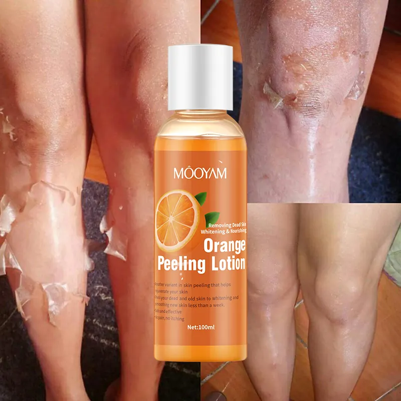 Huid Lichter Whitening Body Peeling Lotion Verhelderende Exfoliërende Verwijderen Dode Huid Glad Hydraterende Oranje Peeling Lotion