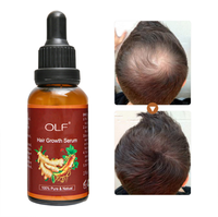 Huile de croissance capillaire naturelle au gingembre sauvage OEM pour hommes noirs, traitement de haute qualité, huile réparatrice capillaire à l'huile d'argan du Maroc