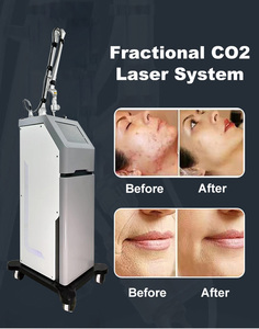 Dispositivo de Belleza 2025 Versión de Lujo, Tratamiento para el Acné con Dióxido de Carbono Indoloro de 1064nm, Rejuvenecimiento de la Piel, Cuidado Vaginal con CO2, para el Cuerpo en Casa - Product Image 2