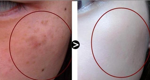 Crème de nuit pour le visage OEM Best <span class=keywords><strong>Royal</strong></span> Expert sans effets secondaires, anti-rides et éclaircissante pour les taches brunes, pour femmes - Product Image 6