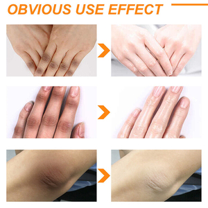 도매 다크 너클 무릎 리무버 미백 표백 오일 세럼 바디 젤 너클 미백 비누 스킨 케어 세트 남녀 공용 성인 - Product Image 6