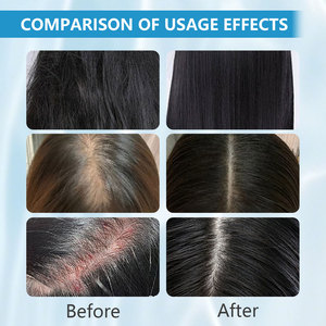 Il Nostro Siero per la Crescita dei <span class=keywords><strong>Capelli</strong></span> a Marchio Privato Più Venduto con Peptidi di Rame Vegani Stimola la Rigenerazione dei Follicoli Piliferi - Product Image 5