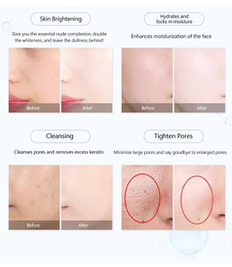Appareil d'électroporation chaud/froid certifié CE D-Cool avec mode pulsé réglable pour soins post-laser en clinique de beauté, compatible OEM - Product Image 2