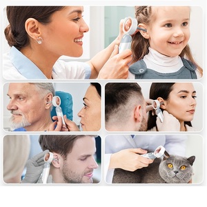 Otoscope <strong>Ear</strong> Camera with 1.38 Degree Screen, 1080P HD <strong>Ear</strong> <strong>Scope</strong> &amp; 4 LED Lights for Adult Kid and Pet, 12 Silicone Specula Tips - Product Image 2