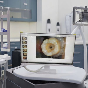 Endoscopio dentale elettrico All-in-One con chiara impugnatura dello schermo di Imaging in tempo reale per una diagnosi efficiente - Product Image 2