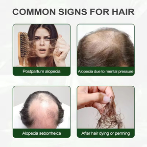 Private Label Polygonum Multiflorum Root Extract Effective Fast Hair <strong>Growth</strong> Treatment Hair Oils for Hair <strong>Growth</strong> - Product Image 5