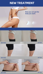 Mới nhất xu hướng cơ thể da thắt chặt giảm cân máy cơ thể hình thành thiết bị chất béo hòa tan hệ thống Trọng lượng giảm cân máy - Product Image 6